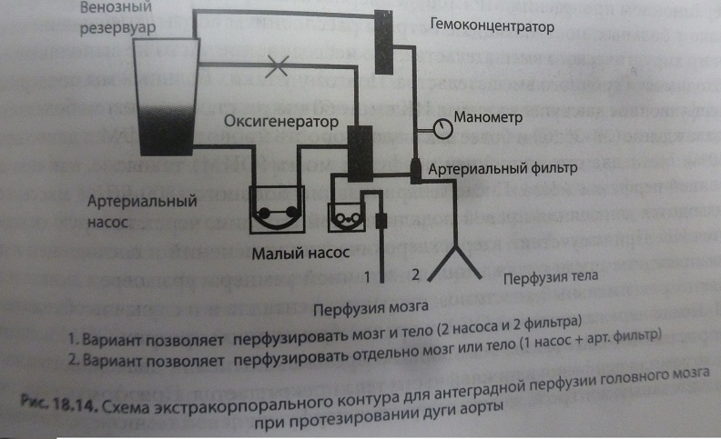 P1010636 - копия.JPG